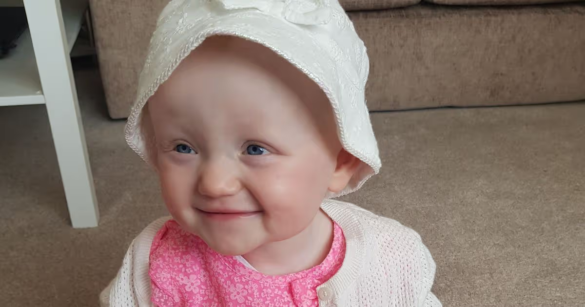 <ol><li><p><span style="color: rgb(159, 124, 44);"><strong>musty od</strong>or pee</span></p></li><li><p><span style="color: rgb(31, 176, 81);"><strong>microcephaly</strong></span></p></li><li><p><span style="color: rgb(39, 150, 161);"><strong>blue eyes &amp; very fair skin w/ light blonde hair</strong></span></p></li><li><p><span style="color: rgb(167, 91, 241);"><strong>FTT</strong></span></p></li><li><p><span style="color: rgb(178, 40, 40);"><strong>heart defects</strong></span></p></li></ol><p></p>