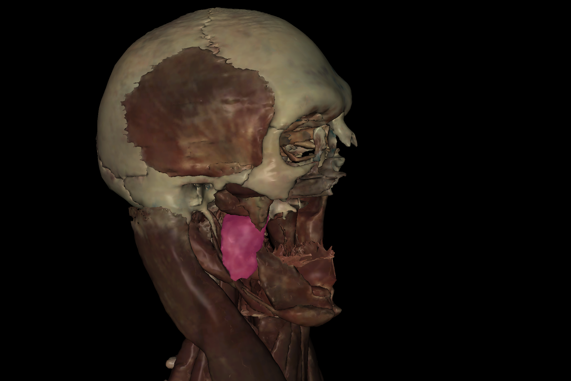 term image