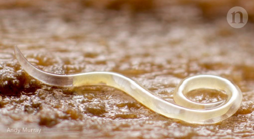 <p>This is an example of a ______, commonly known as roundworms</p>