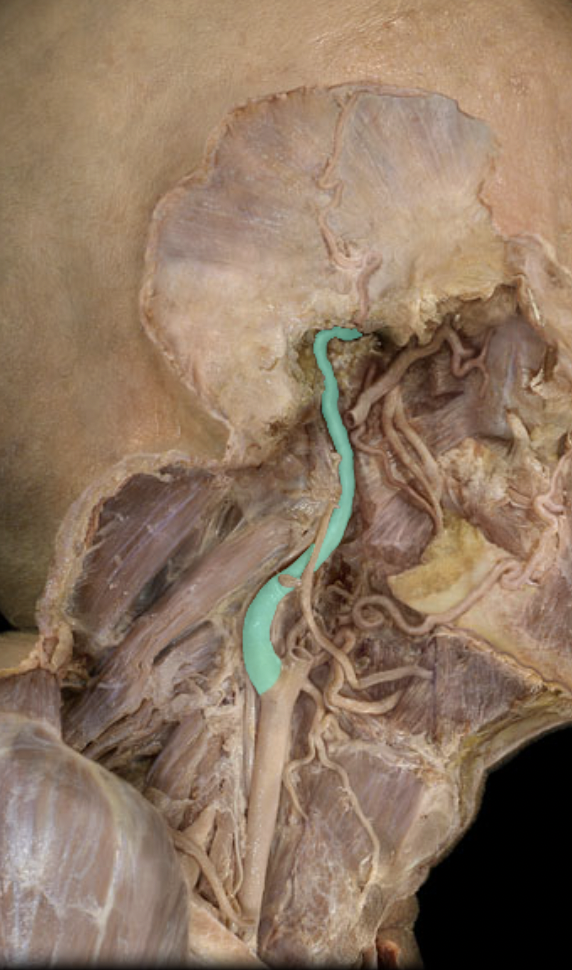 <p>Identify the artery to the brain (circle of willis)</p>