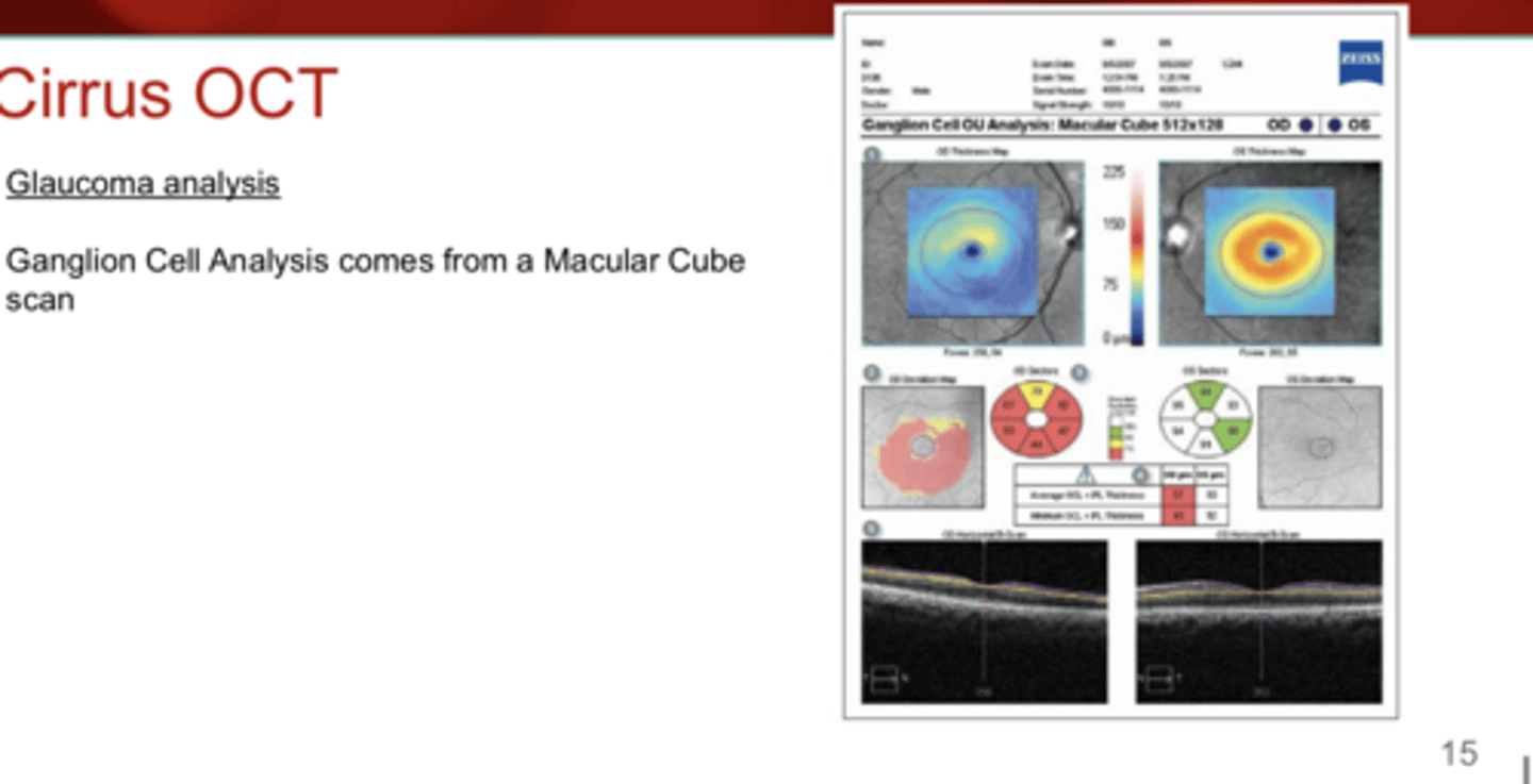 <p>Ganglion Cell Analysis comes from a ______ scan</p>