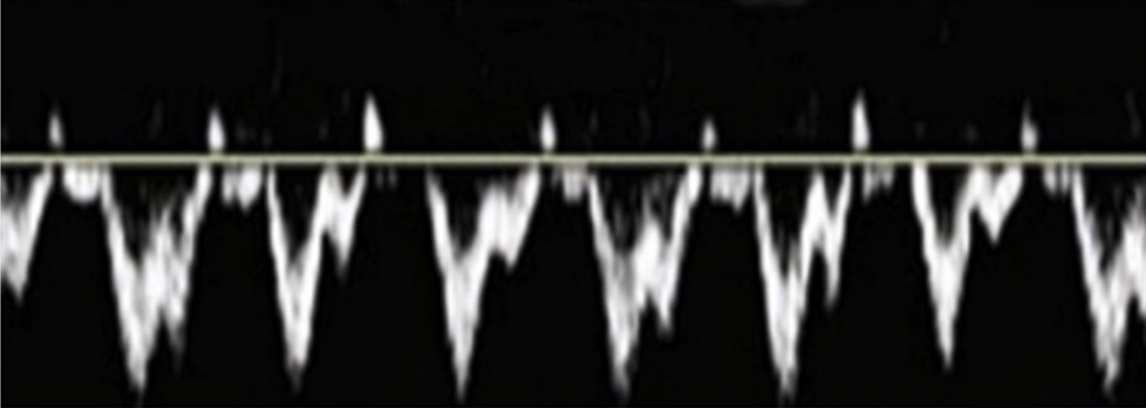 <p>What is the best way to describe this waveform?</p>