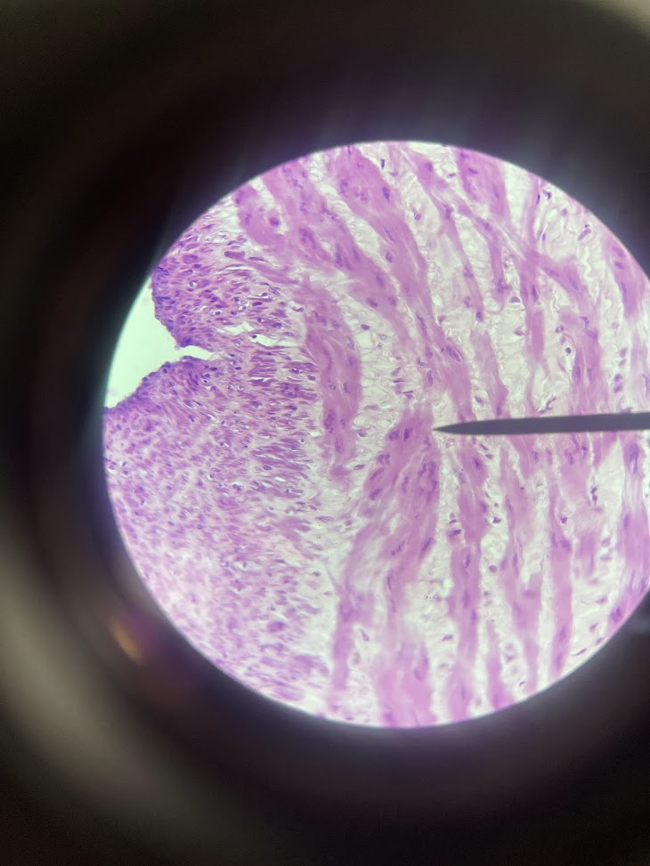 <p>structure name + layer name</p>