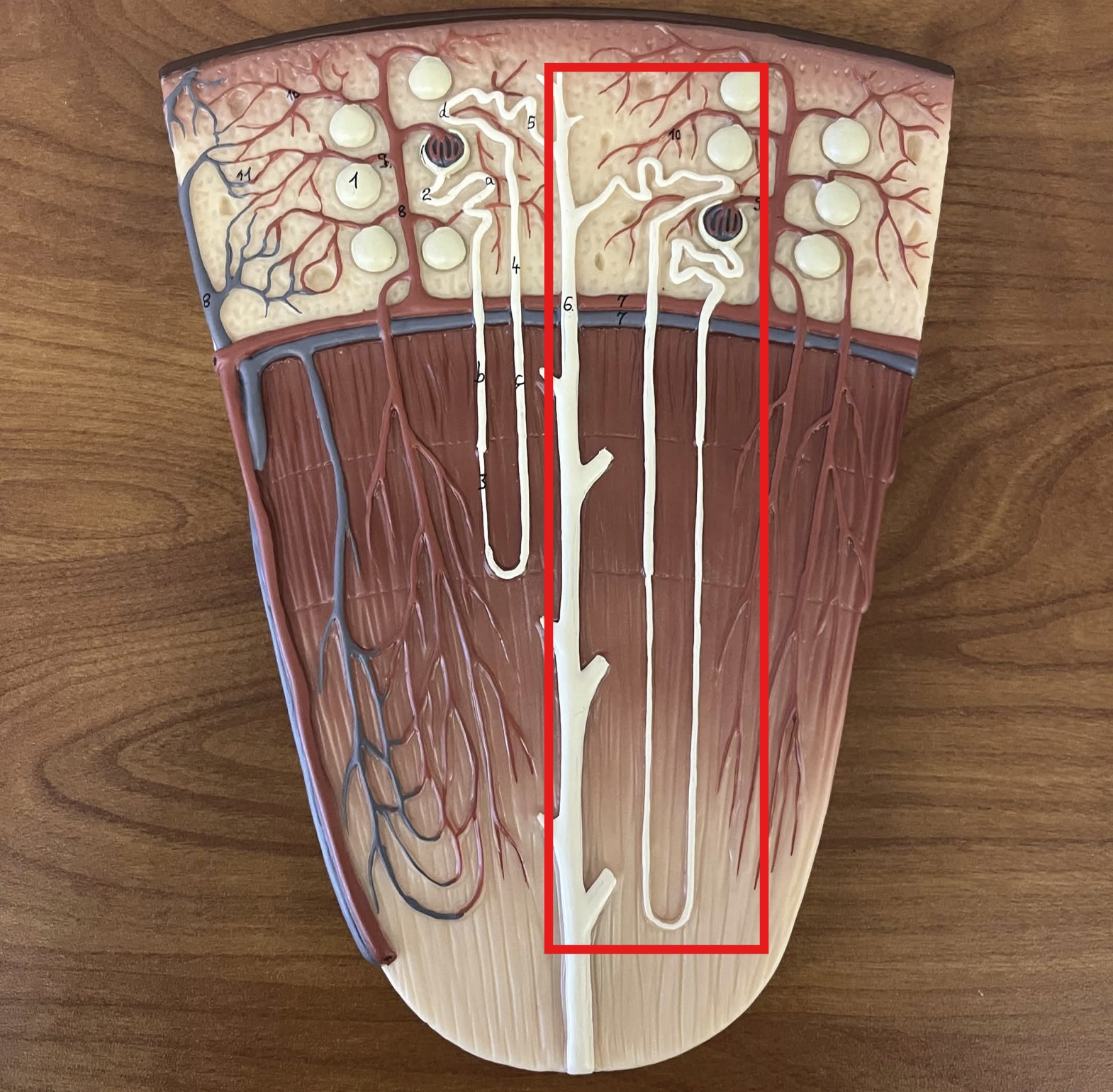 <p>Which type of nephron is this?</p>