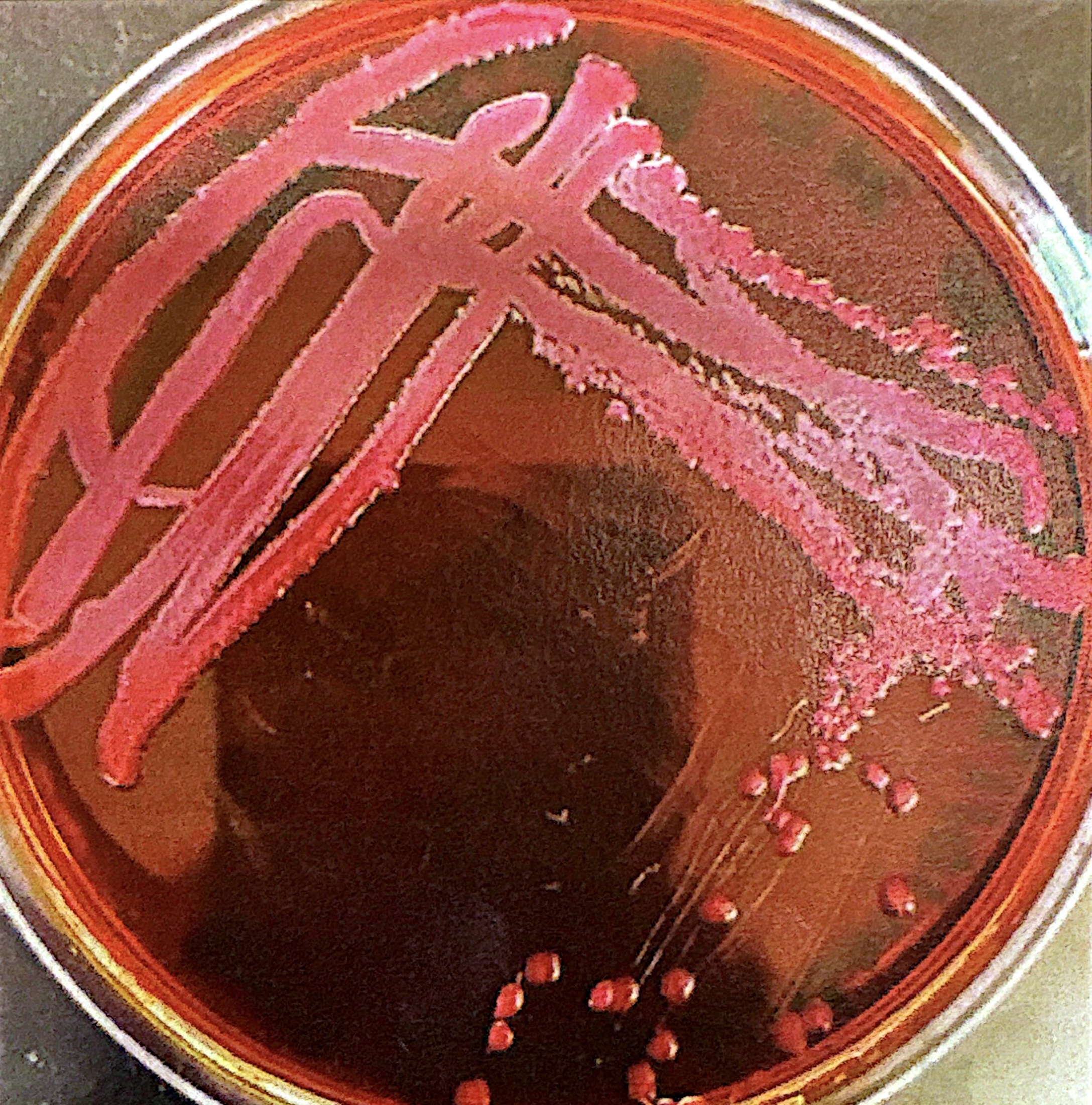 <p><span style="background-color: transparent;">dark/dark purple colonies on EMB</span></p>
