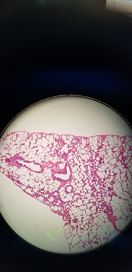 <p>what is outlined?</p>