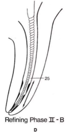 <p>return to #25 last file (MAF)</p><p>short of working length to smooth the step back with vertical push-pull strokes (circumferential filing) H-files used</p><p>guttmann “final prep should be exact replica of original canal configuragtion'“</p><p><span>always smoothen the area using <strong>MAF </strong>with <strong>filing motion </strong>(push – pull motion) to <strong>scrape off </strong>the steps created</span></p>