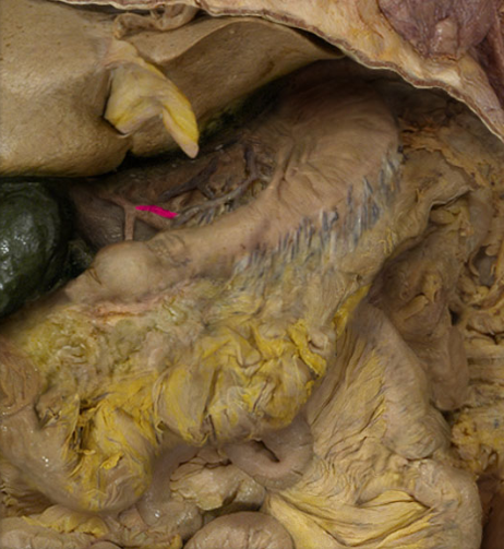 term image