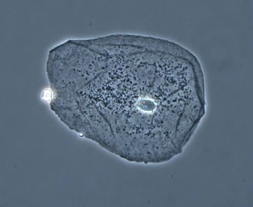 <p>Which contrast method is this? What external components does it require?</p>