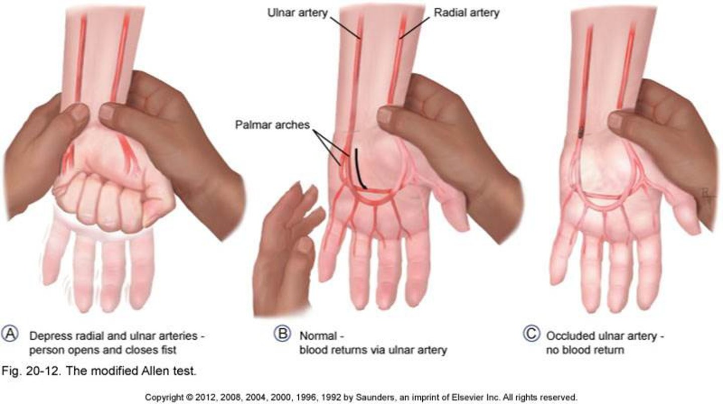 <p>Vascular compromise of the hand</p>