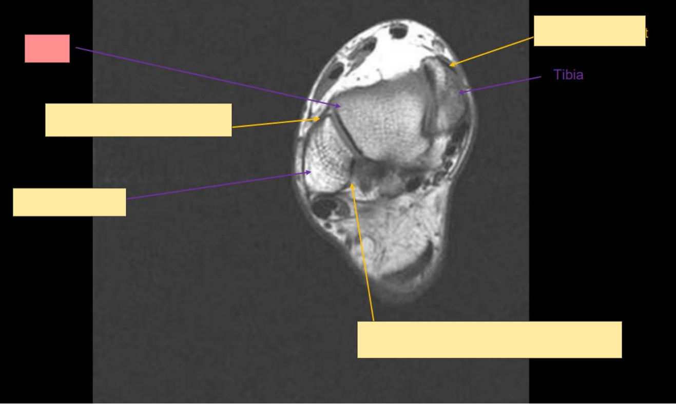 <p>Identify this structure</p>