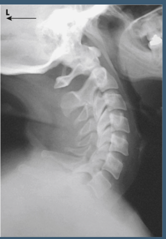 <p>what view is this </p>