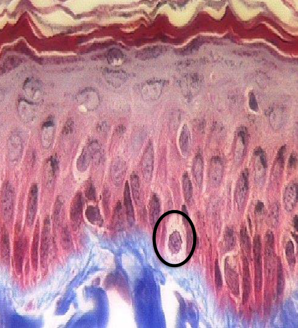 <p>What cell is this? Keratinized or Non-keratinized?</p>