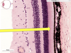 <p>identify the specific layer of the retina</p>