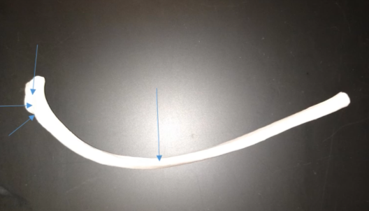 <p>What is the middle part of the rib called?</p>