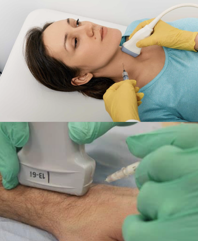 <ul><li><p>MC used</p></li><li><p>advantage</p><ul><li><p>good when accessing superficial structures</p></li></ul></li><li><p>disadvantages</p><ul><li><p>difficult to use during renal biopsy</p></li><li><p>potentially longer procedure time</p></li><li><p>challenging to access deep lesions</p></li></ul></li></ul><p></p>