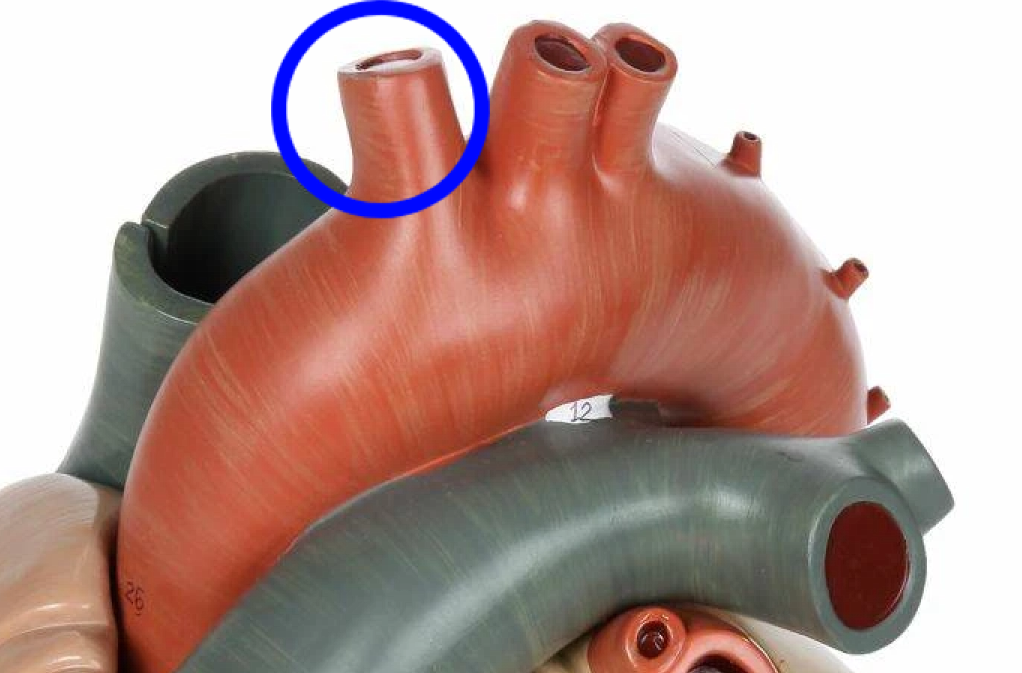 <p>The (anatomically) rightmost branch of the aorta</p>