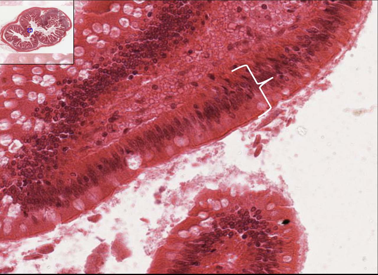 <p>What type of tissue is this?</p>