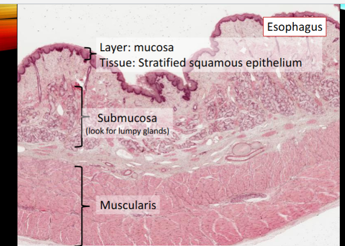 <p>nonkeratinized stratified squamous epithelium (histology)</p>
