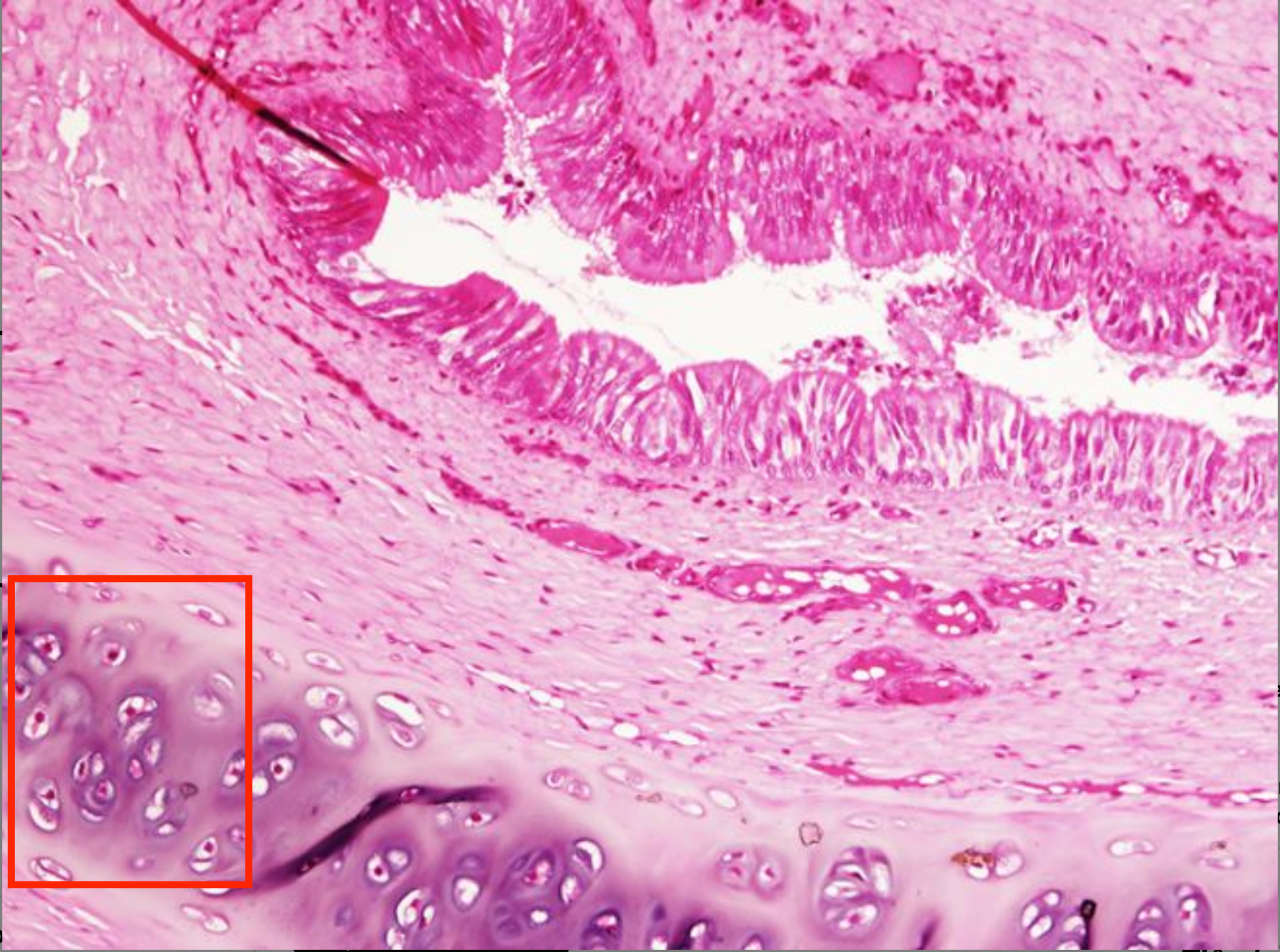 <p>Khí quản (có sụn hyaline)</p>