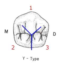 <p>- Y pattern</p><p>- central and lingual grooves</p><p>- cusp size is largest to smallest B, ML, DL</p><p>- all cusps have 4 cusp ridges</p>