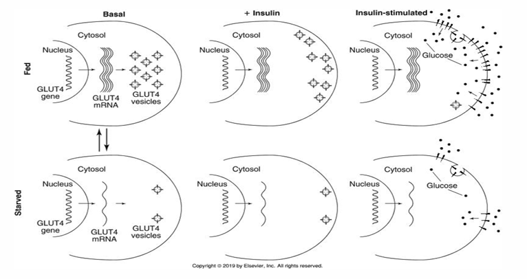 <p>transcription and translation of GLUT 4 is decreased (less made)</p>