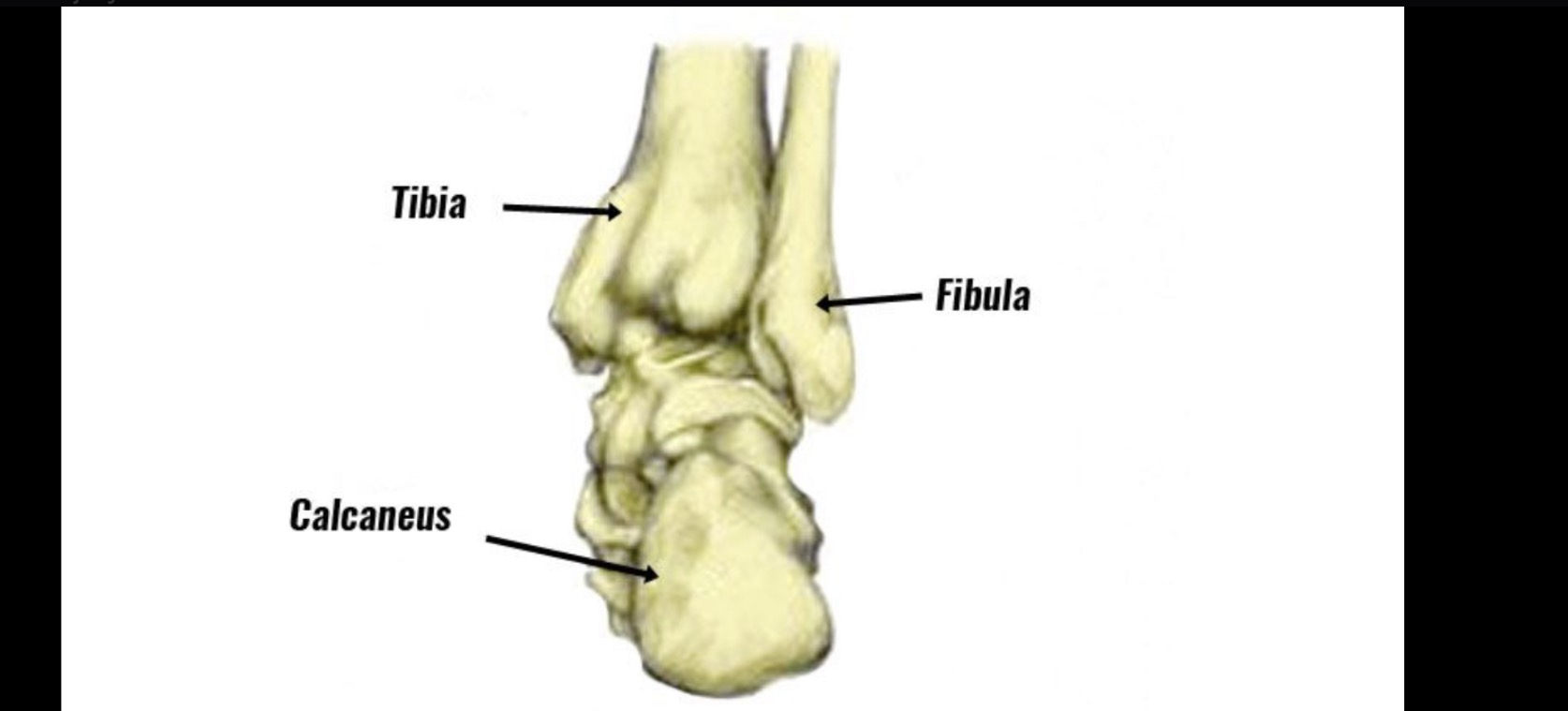 <p>Heel</p>