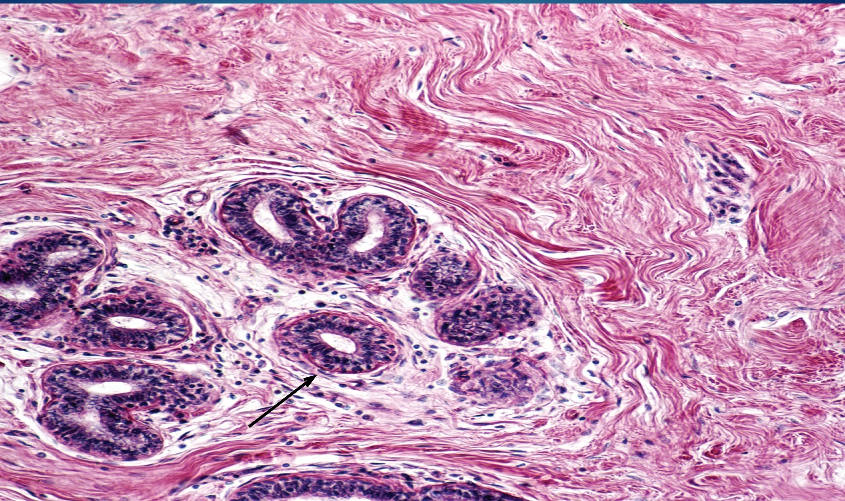 <p>What type of connective tissue is found further away from the glomular epithelial tissue</p>