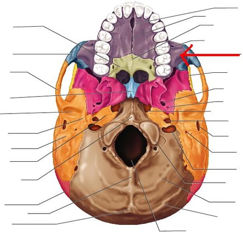 term image