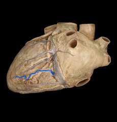 <p>identify the structure</p>