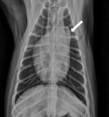 <p>ID the lesion associated with pulmonic stenosis</p>