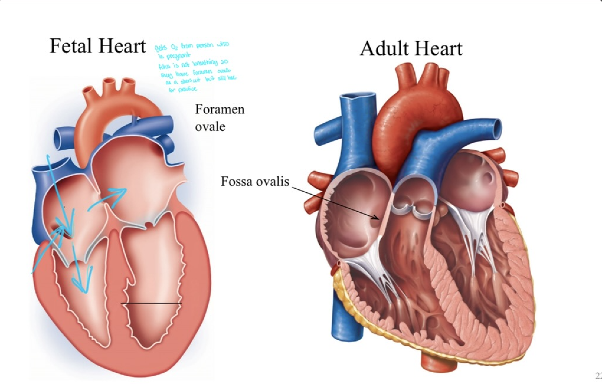 <p>Fetal heart</p><ul><li><p>gets O2 from person who’s pregnant </p></li><li><p>fetus is NOT breathing so they have <strong>foramen ovale </strong>as shortcut but still have for practice</p></li></ul><p></p>