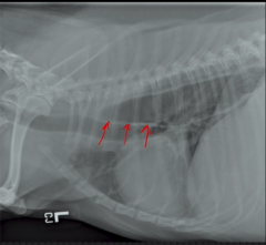 <p>What is the name of this soft tissue band which is typically seen when an esophagus is distended with air?</p>