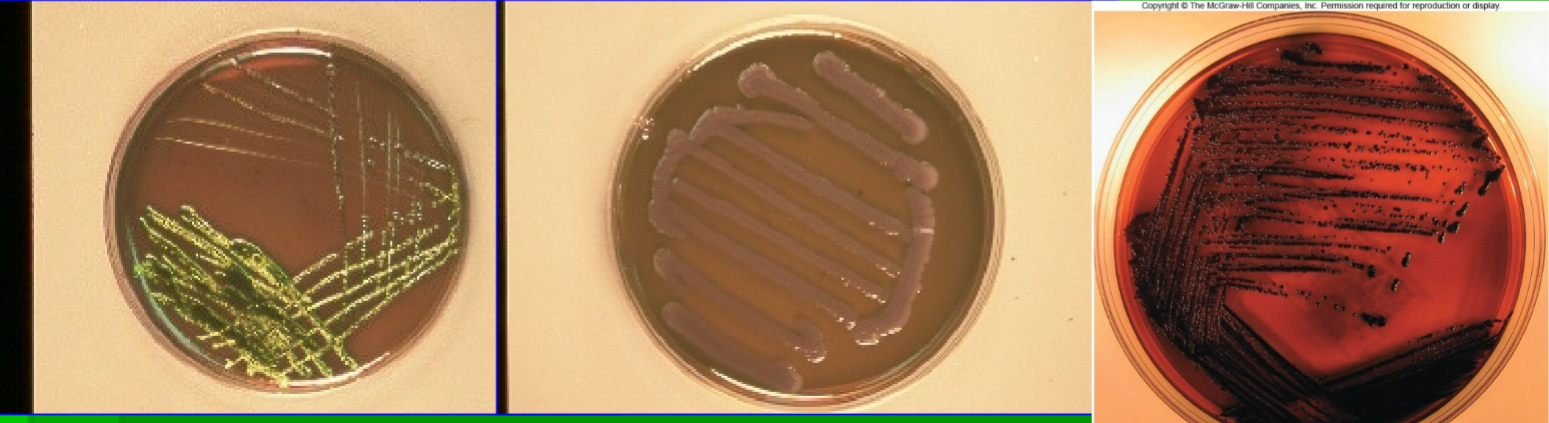 <p>Eosin Methylene Blue (EMB) tests for</p>