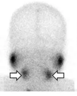 <p>what does this salivary test indicate </p>