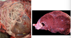 <p>What is this gross image showing?</p>
