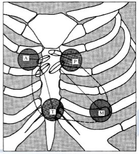 <p>The four sites are the aortic (A), pulmonary (P), tricuspid (T), and mitral area (M).</p>
