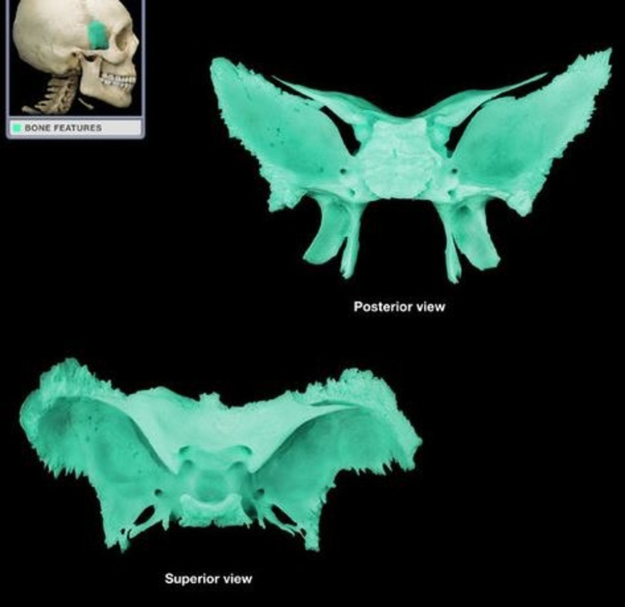 <p>What bone is this?</p>