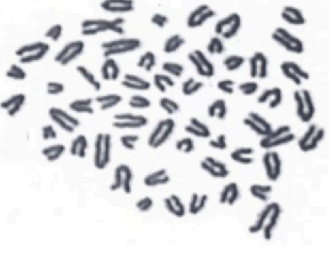 <p><span style="line-height: 20.85px;">Podaj zapis kariotypu przedstawionych poniżej przypadków (gatunek, liczbę chromosomów, płeć, rodzaj mutacji).<strong> </strong></span></p><p><span style="line-height: 20.85px;"><strong><u>Jeśli to możliwe</u></strong> wskaż chromosomy płci i ewentualne chromosomy które uległy mutacjom.</span></p>