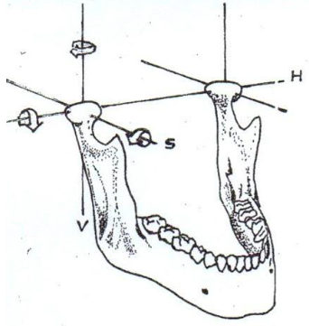 <p><span style="color: red;">vertical axis</span> → lateral rotation</p><p><span style="color: red;">horizontal / hinge axis</span> → opening/closing</p><p><span style="color: red;">sagittal axis</span> → orbiting condyle movement during lateral excursions</p>