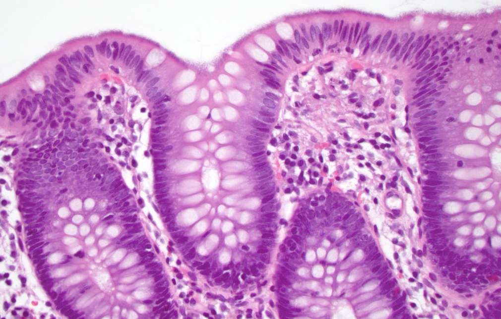 <p>1) Diagnostic</p><p>2) quel test faire </p>