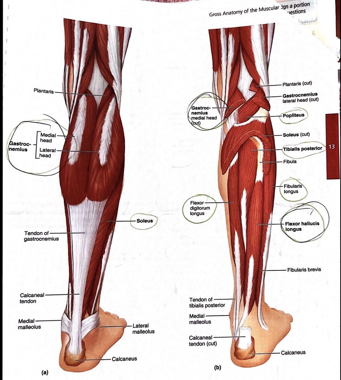 <p><span><span>Tibialis posterior</span></span></p>