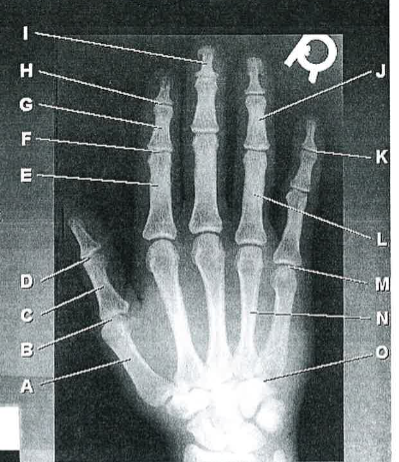 <p>I</p>