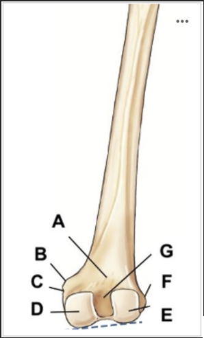 <p>Label the image: A</p>