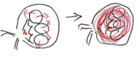 <p>Végállapot vese alakul ki, gyakran glomerulonephritis kapcsán, mert megnő az áteresztőképesség</p><p>Hyalin: plazmafehérjék, mesangialis mátrix, kollagén</p>