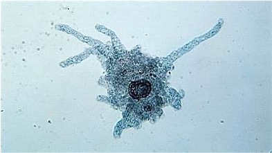 <p>A blob-like shape, uses pseudopodia for motility</p>