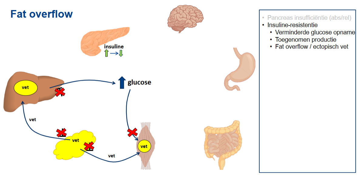 <ul><li><p><strong>Fat overflow</strong> betekent dat er meer vet wordt opgeslagen dan de normale opslagcapaciteit van het vetweefsel aankan.</p></li><li><p>Wanneer de normale vetopslagcapaciteit wordt overschreden, kan vet zich op andere plaatsen ophopen.</p></li><li><p>Vet dat zich bevindt op plaatsen waar het normaal niet of in mindere mate wordt opgeslagen, wordt <strong>ectopisch vet</strong> genoemd.</p></li><li><p>De presentatie beschouwt fat overflow als een onderdeel van de pathofysiologie van diabetes type 2.</p></li><li><p>Daarmee wordt duidelijk dat niet alleen de hoeveelheid vet belangrijk is, maar ook <strong>waar het vet zich in het lichaam bevindt</strong>.</p></li><li><p>Fat overflow wordt in het totale schema geplaatst naast pancreasinsufficiëntie, insulineresistentie, verminderde glucose-opname en toegenomen glucoseproductie.</p></li></ul><p></p>