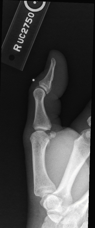 <p>Which x-ray projection + structure is shown?</p>