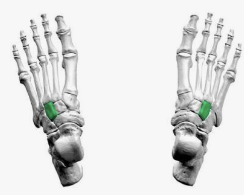 <p>Which bone is this?</p>