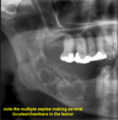 <p>Describe the internal architecture of the lesion: (3)</p>